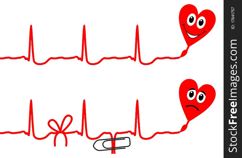 Illustration of cardiogram line with two hearts