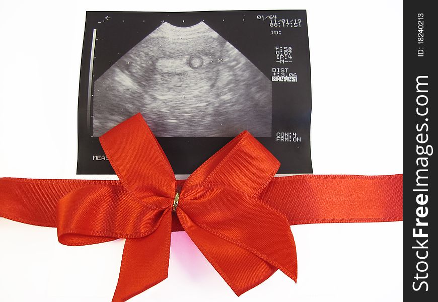 Ultrasonography of 3-4 weeks Fetus. Ultrasonography of 3-4 weeks Fetus