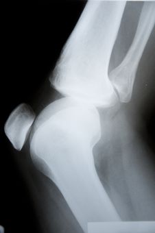 X-ray Pathology Stock Photos X-ray Pathology Stock Photos