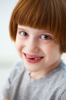 Cute Smiling Girl Missing Front Teeth Stock Photos Cute Smiling Girl Missing Front Teeth Stock Photos