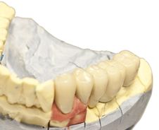 Denture Model Stock Photos Denture Model Stock Photos