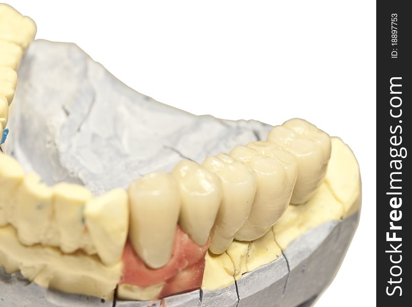 Denture model close up isolated on white