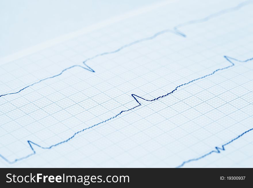 Close-up view on cardiogram. Medical abstract still-life. Blue toned. Close-up view on cardiogram. Medical abstract still-life. Blue toned