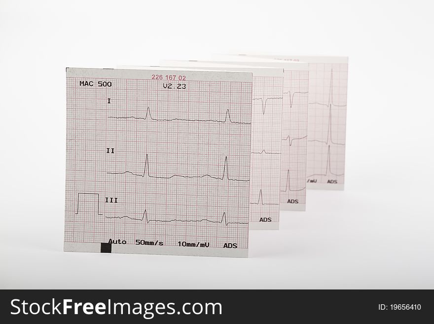 Photo of real electrocardiogram graph