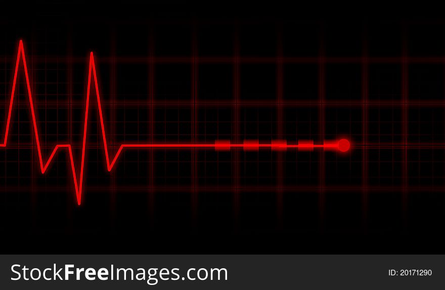 Digital illustration of ECG Electrocardiogram