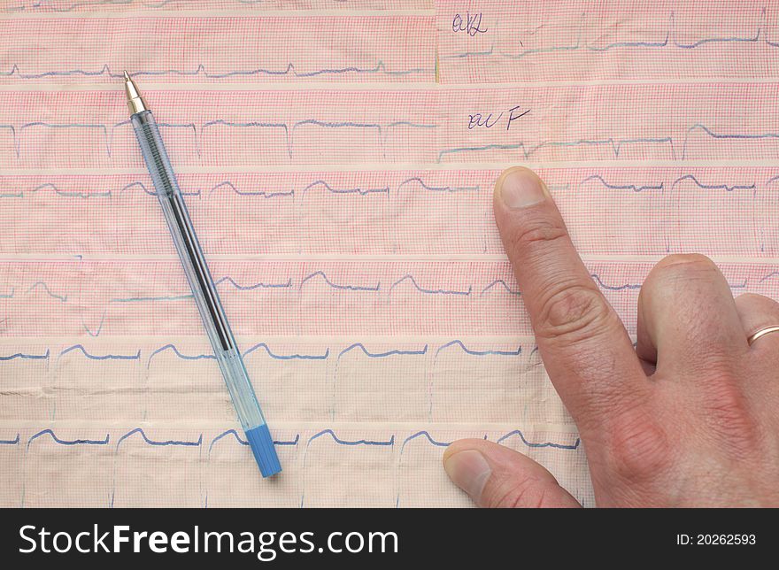 Indicate An Element Of ECG