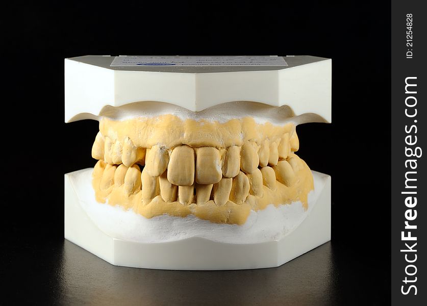 Dental impression for the realization of a device for the correction of the teeth. Dental impression for the realization of a device for the correction of the teeth