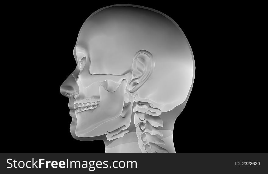 X-Ray Of Human Head