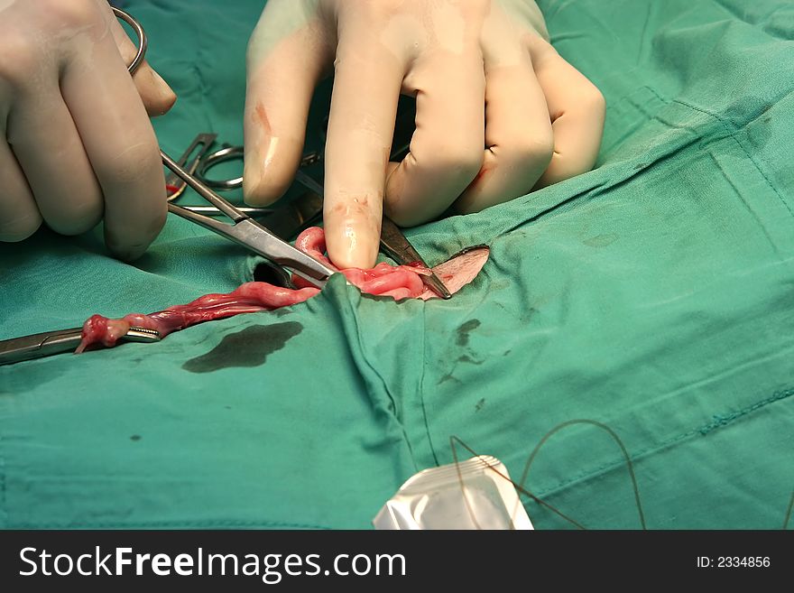 Surgical Procedure