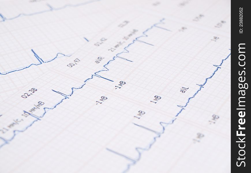 Electrocardiogram