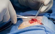 Surgery Operation Royalty Free Stock Photos Surgery Operation Royalty Free Stock Photos