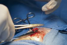 Surgery Operation Royalty Free Stock Photo Surgery Operation Royalty Free Stock Photo