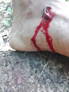 The Leech Is A Very Weak Animal That Lives In Sri Lanka Stock Images The Leech Is A Very Weak Animal That Lives In Sri Lanka Stock Images