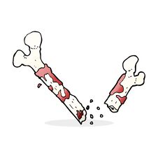 Gross Broken Bone Cartoon Stock Photos