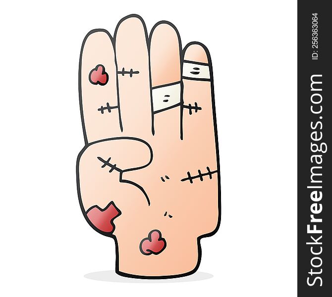 Cartoon Injured Hand