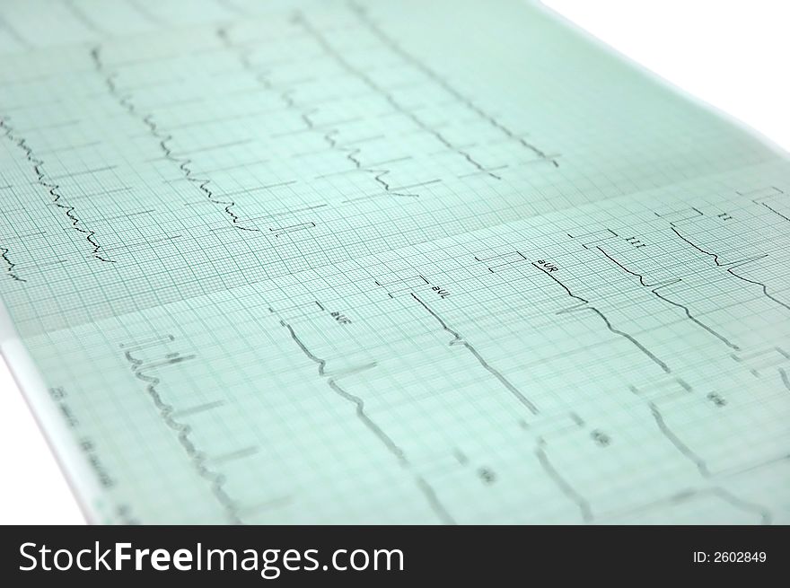 Medical research, electrocardiogram printed on the paper