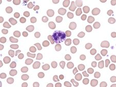 Free Normal Basophil In Peripheral Blood. Wright X1000. Royalty Free Stock Photos - 282410478