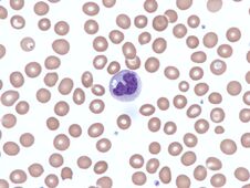 Free Normal Monocyte In Peripheral Blood. Wright X1000. Royalty Free Stock Photos - 282410518
