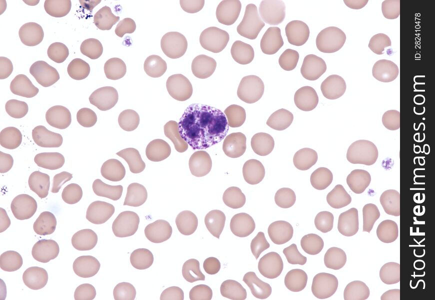 Normal basophil in peripheral blood. Wright x1000.