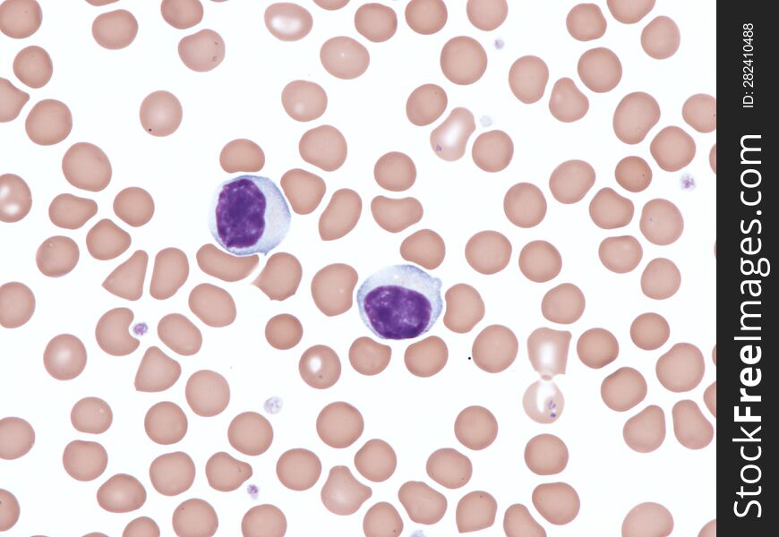 Normal lymphocytes in peripheral blood. Wright X1000.