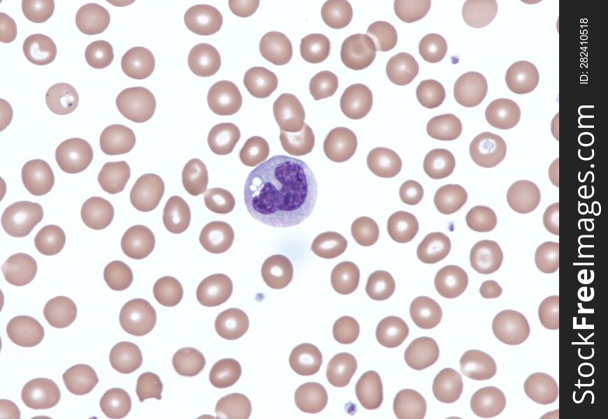 Normal Monocyte In Peripheral Blood. Wright X1000.