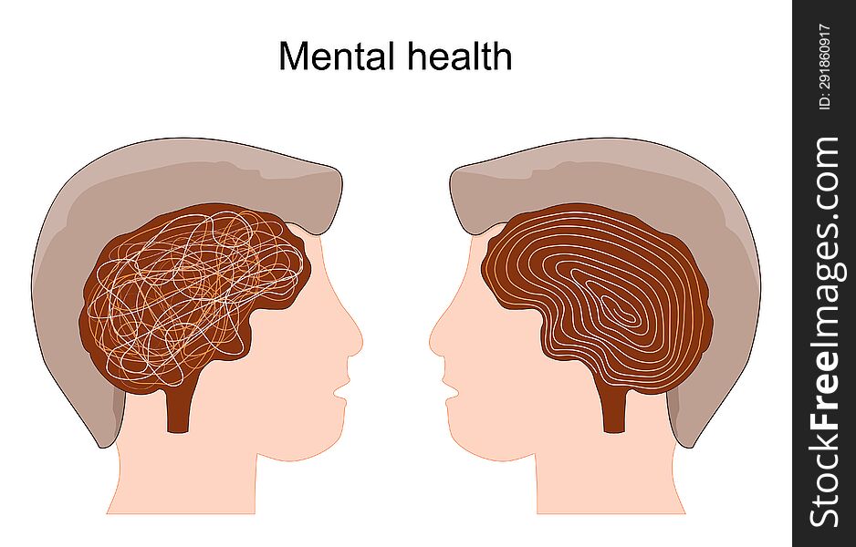 Mental Health. Concept With Human& X27 S Heads And Brains. Confused Thoughts.  Poster