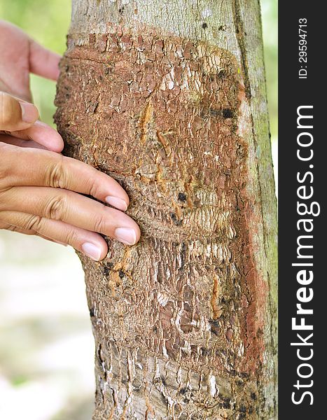 Natural rubber Disease with hand