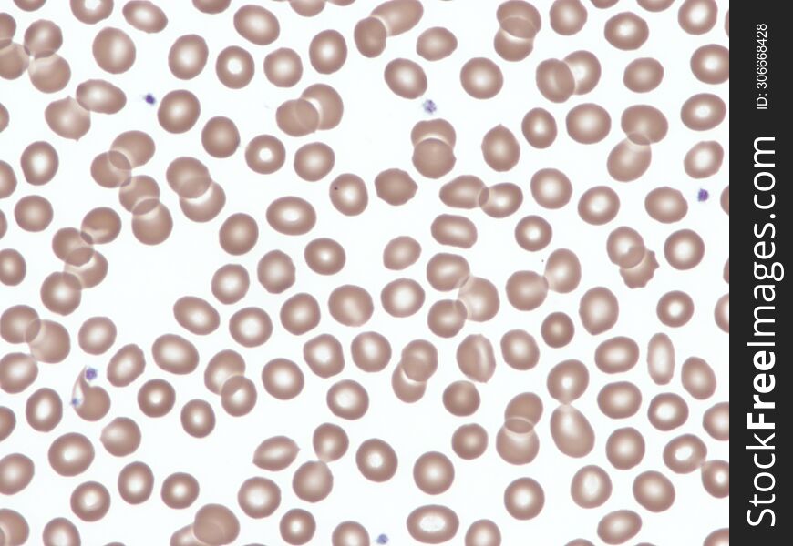 Red blood cells in a peripheral blood smear. Wright x1000.