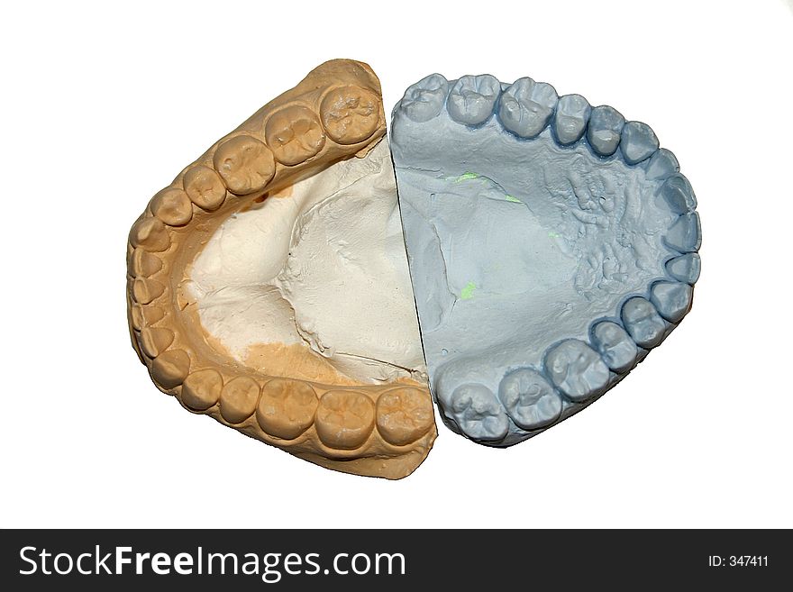 Cast Teeth Model