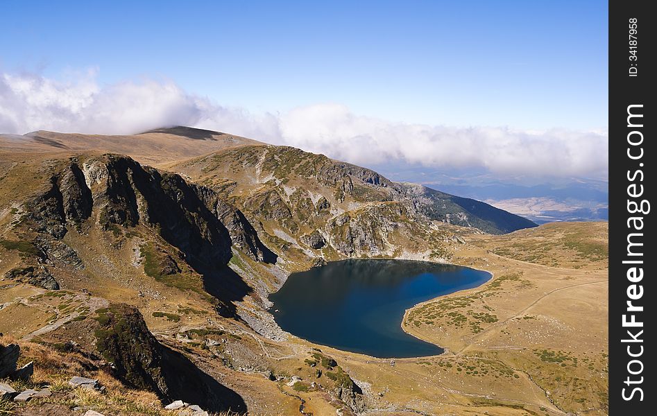 Lakes Bulgaria-kidney