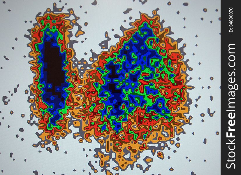 Thyroid Pathology  Scan