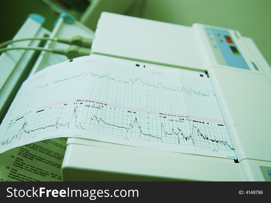 A device metering heart pulsation