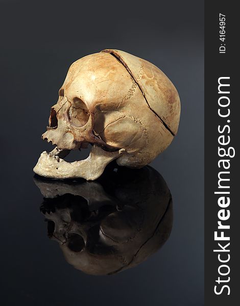 Real Skull