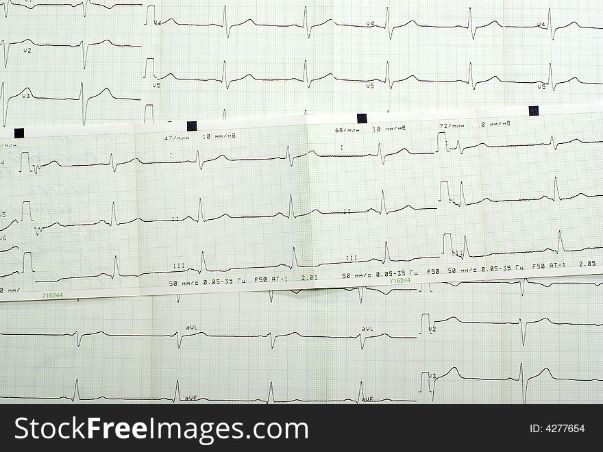 Cardiogram Background