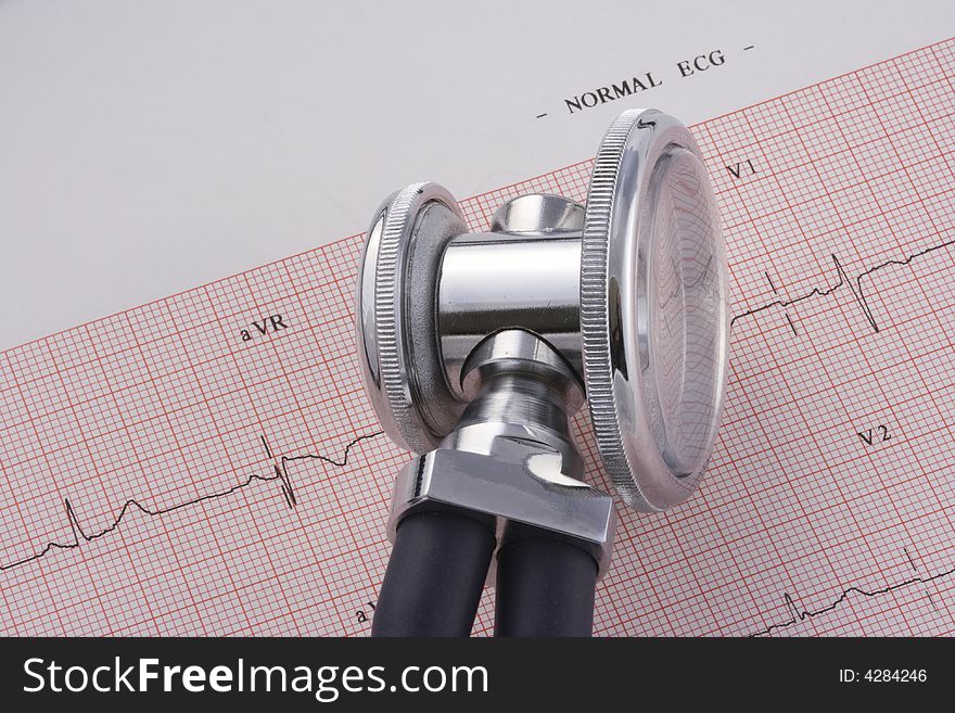 Closeup of an EKG chart and a stethoscope. Closeup of an EKG chart and a stethoscope.