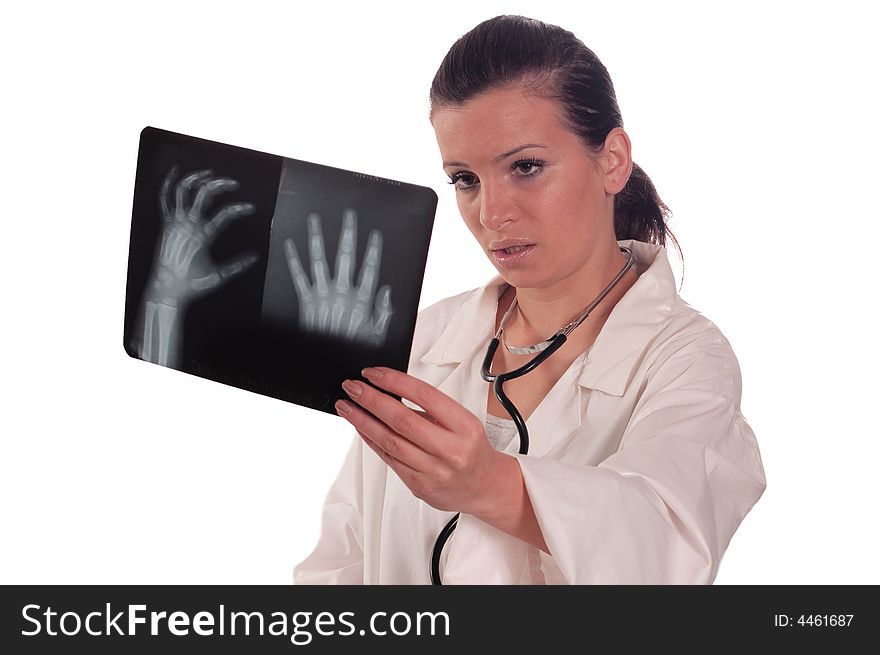 Doctor female holding x ray of hand