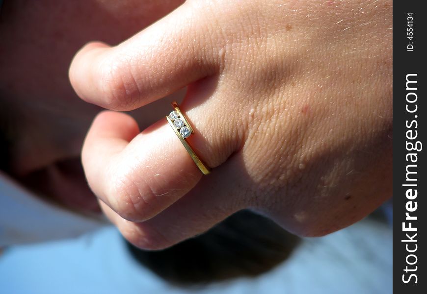 A ring on a deformed hand. A ring on a deformed hand