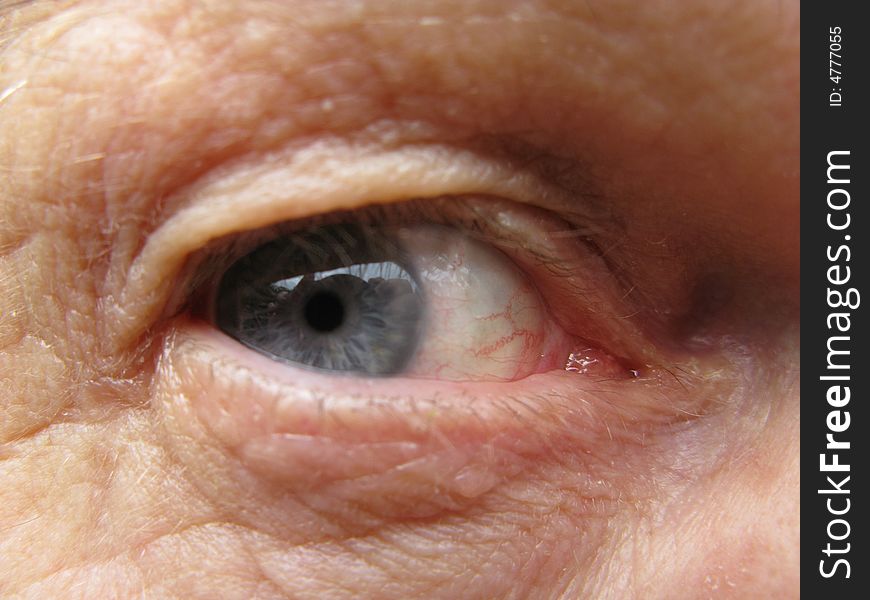 Senior Males Eye
