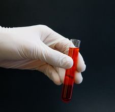 Gloved Hand Holding Test Tube Stock Photos