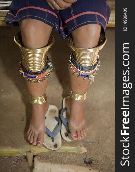 Knee decorated with brass rings of a long-necked karen women, Thailand