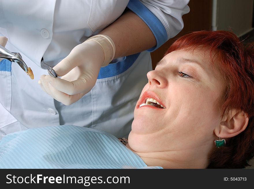 Woman with open mouth look on her extract tooth. in dental clinic