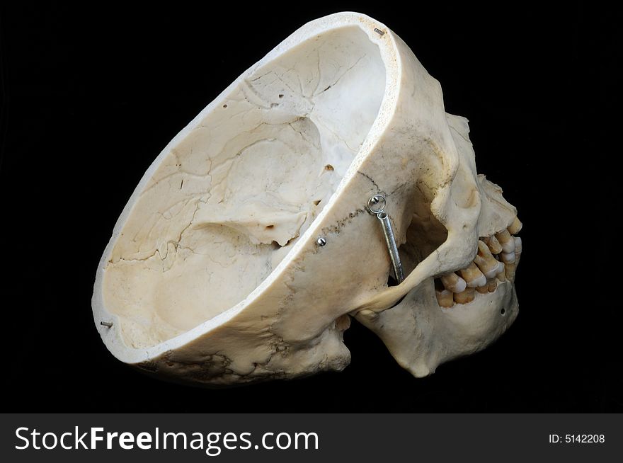 A real human skull with the cap cut away to show the interior of the brain case. A real human skull with the cap cut away to show the interior of the brain case.