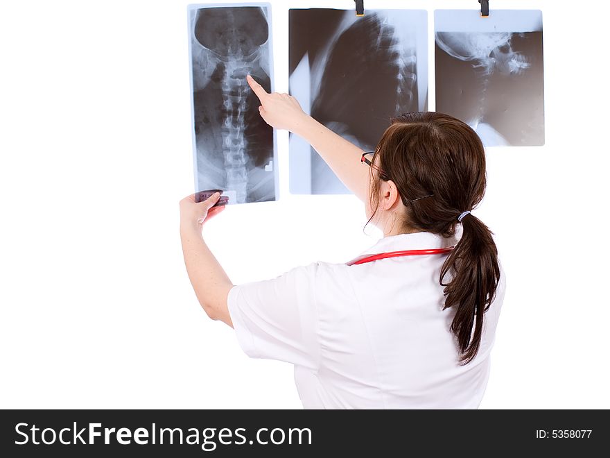 Doc looking at x-ray, two other x-rays on the wall, spine, backbone. Doc looking at x-ray, two other x-rays on the wall, spine, backbone