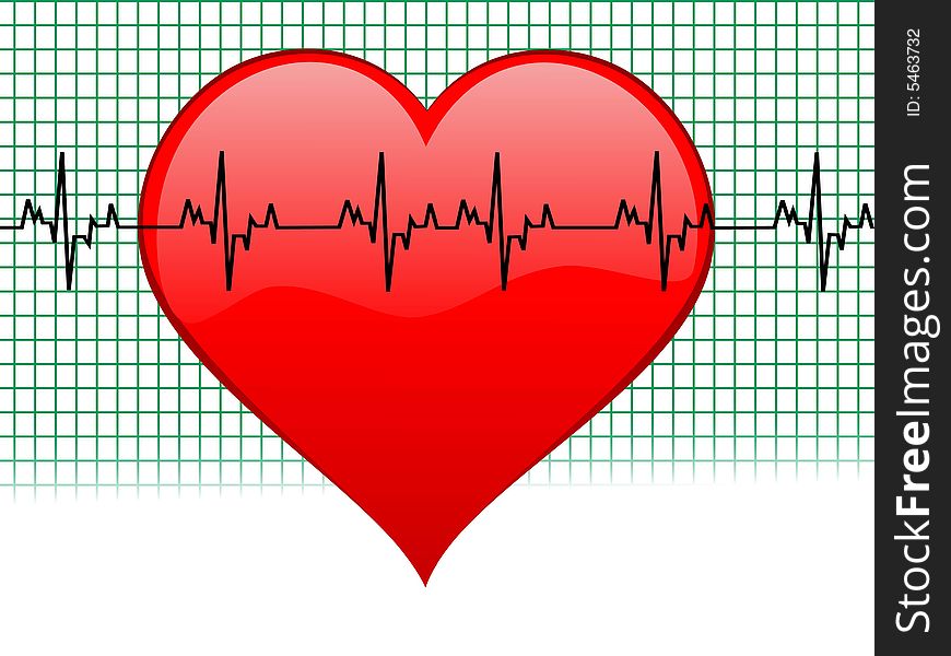 Heartbeat on graph with abstract background