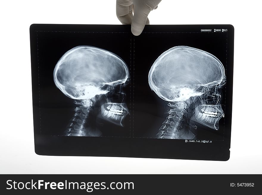 X-rays of human head. X-rays of human head