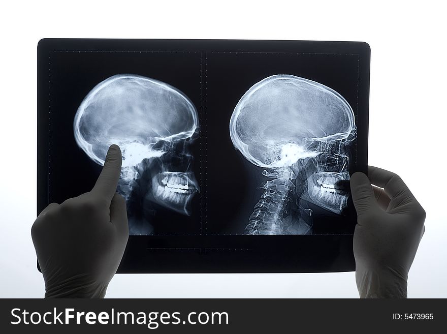 X-rays of human head. X-rays of human head