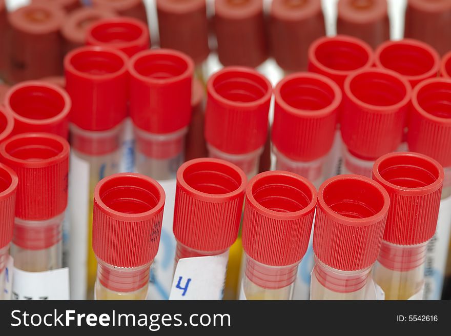 Close-up of some test tubes in a laboratory