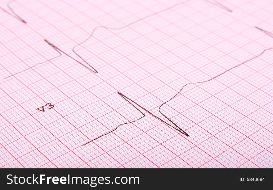 Close-up Of Ecg Graph