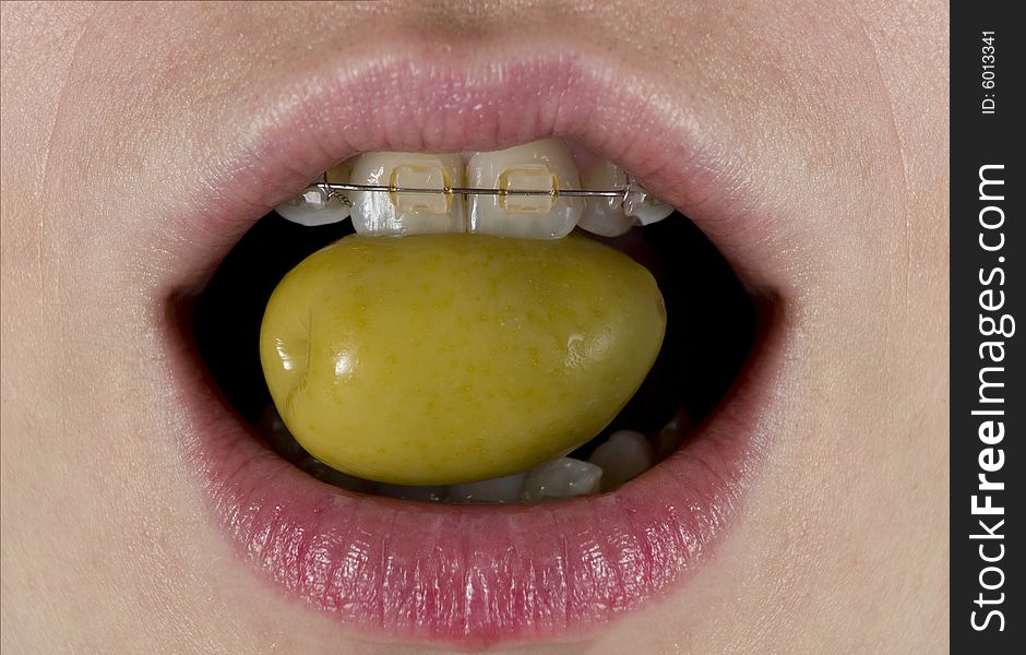 A green olive about to be eaten for a woman with braces. A green olive about to be eaten for a woman with braces.