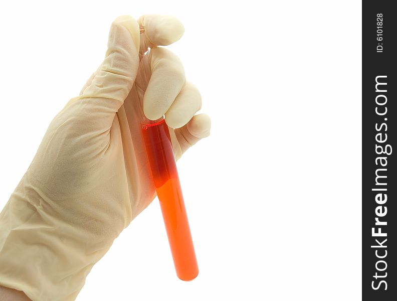 Hand holding blood in test tube.